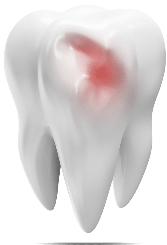 damaged tooth graphic