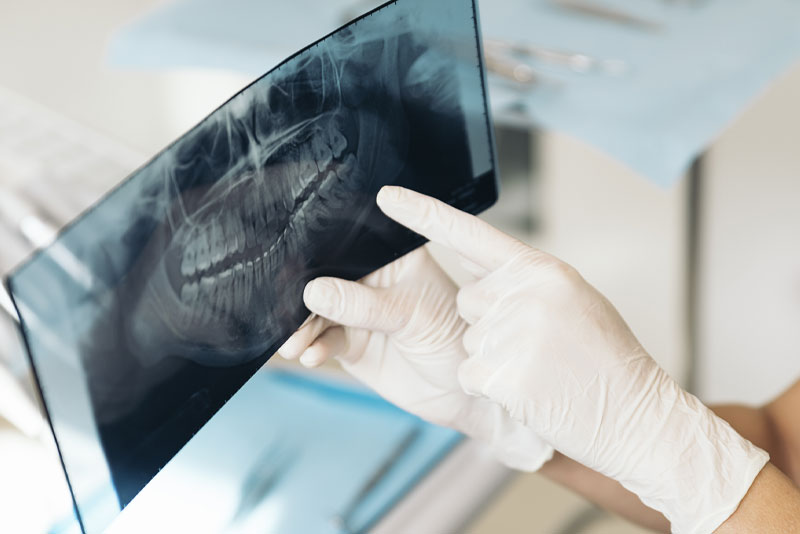 dental xray