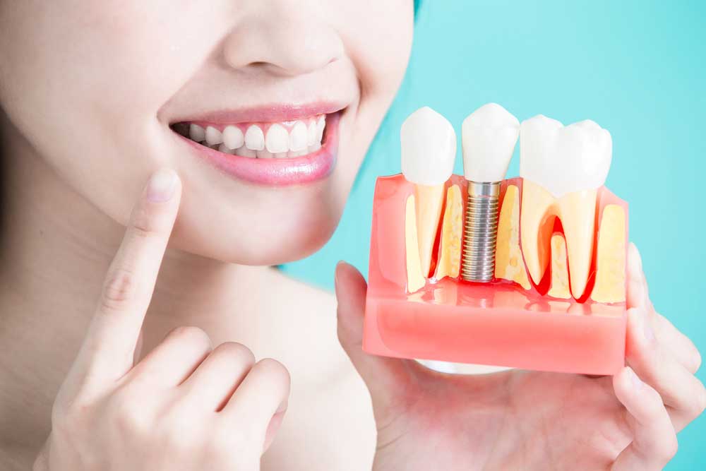 a dental patient holding a model of a placed dental implant
