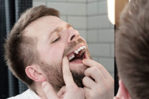 Dental Implant Patient Missing His Top Right Premolar